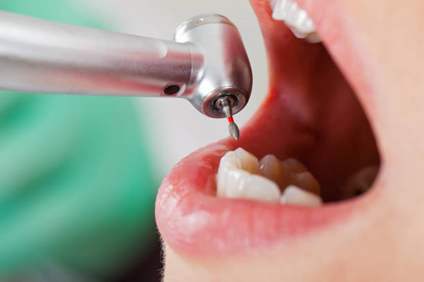 Best Urgent Tooth Repair  in Whitestown, IN